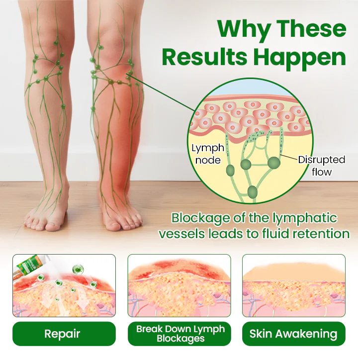 Timilk® VenoLift Leg Relief Spray